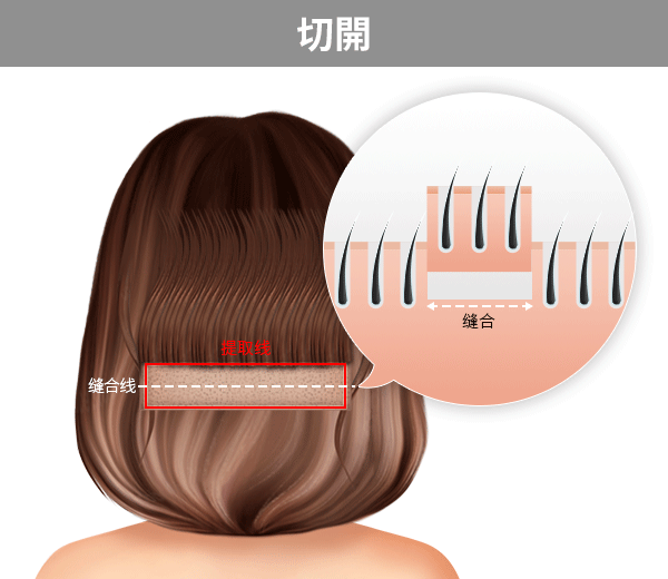切开