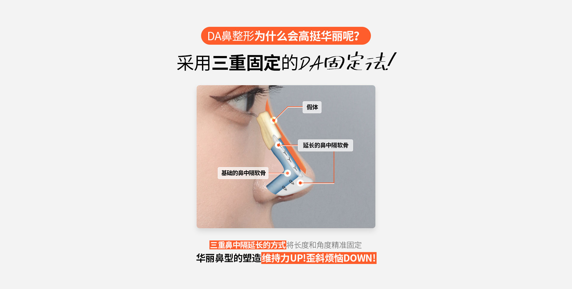 自体肋软骨鼻整形