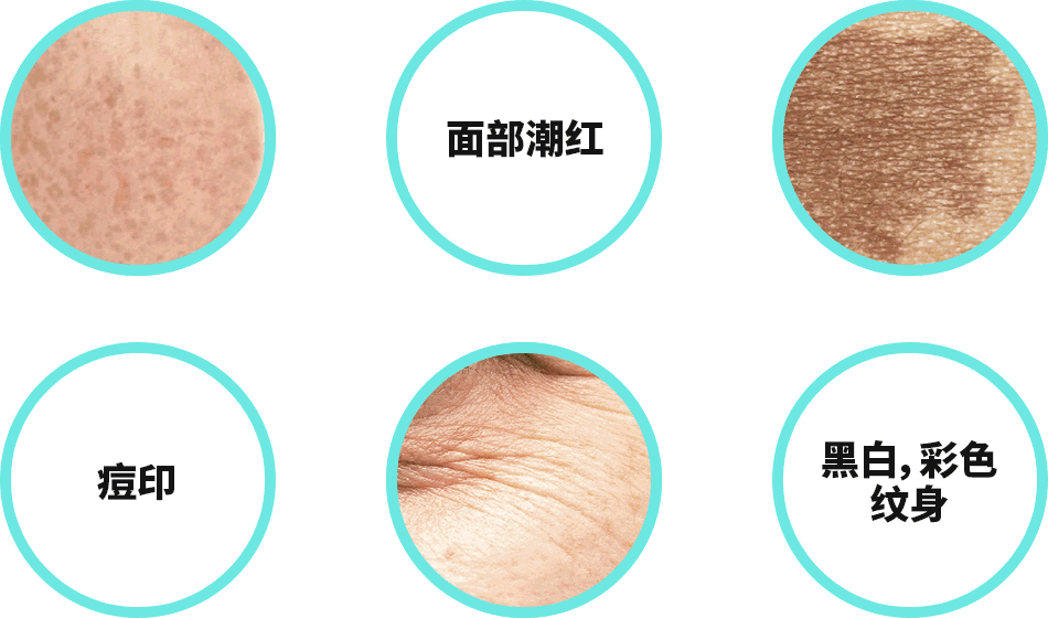 DA皮秒激光
