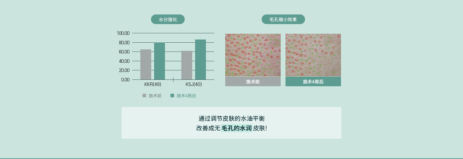 通过调节皮肤的水油平衡改善成无毛孔的水润皮肤!