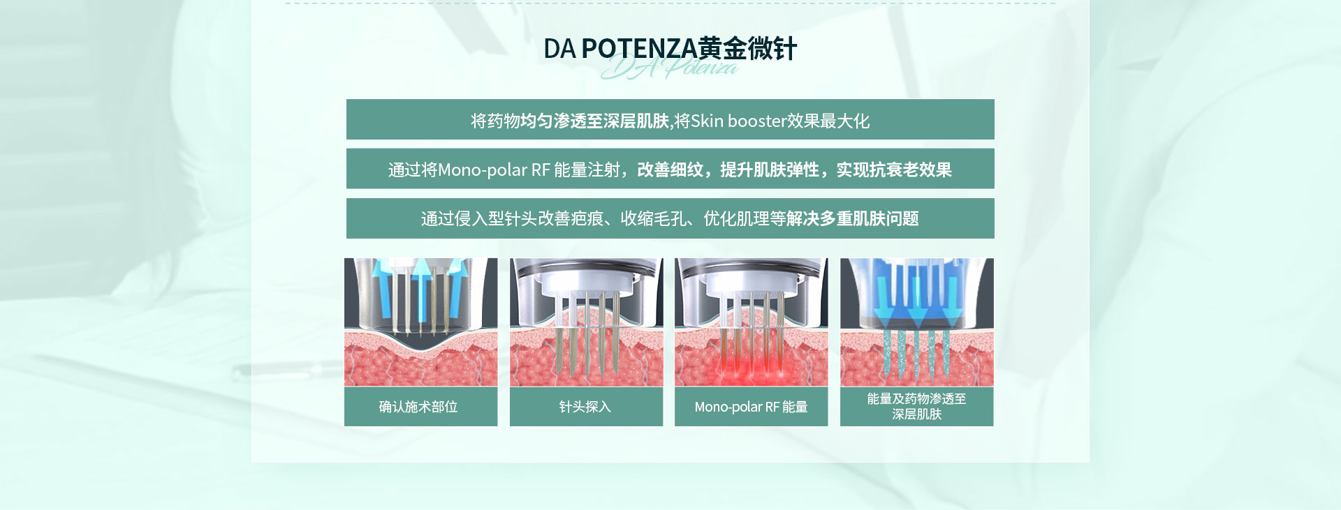 与DA丽珠兰搭配的优选施术-DA POTENZA黄金微针