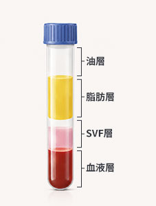 萃取SVF