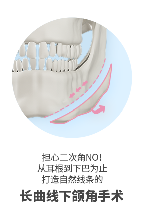 轮廓三件套