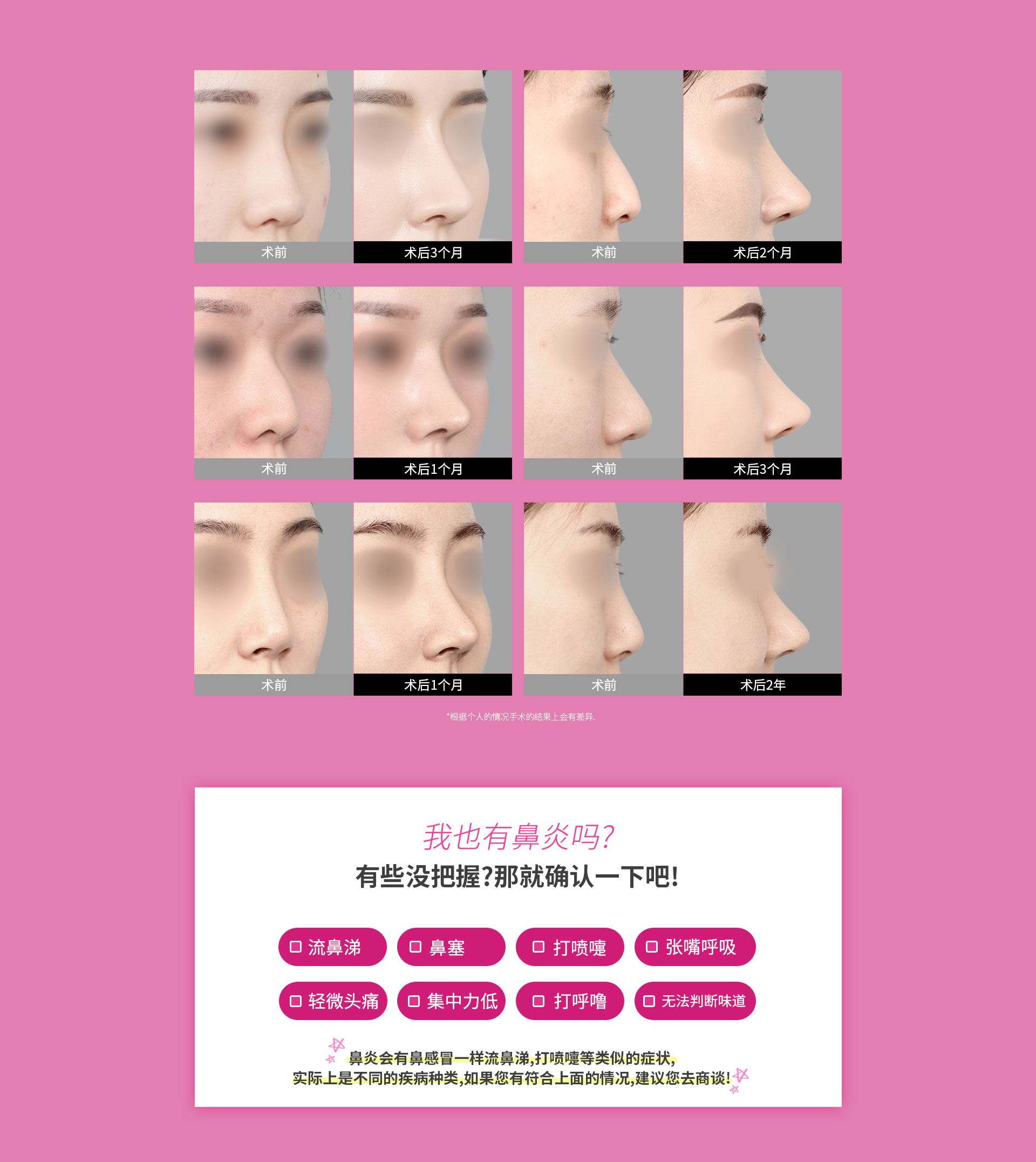 我也有鼻炎吗?有些没把握?那就确认一下吧!