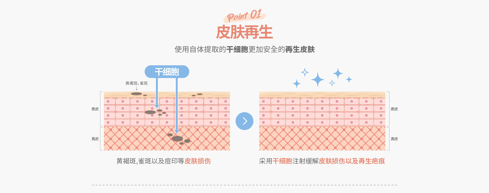 韩国DA整形医院 超声刀管理