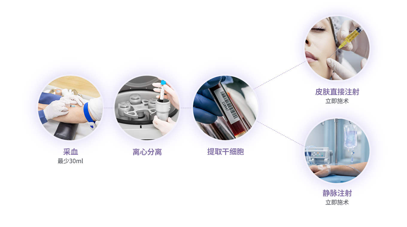 DA 自体血液干细胞治疗的施术流程