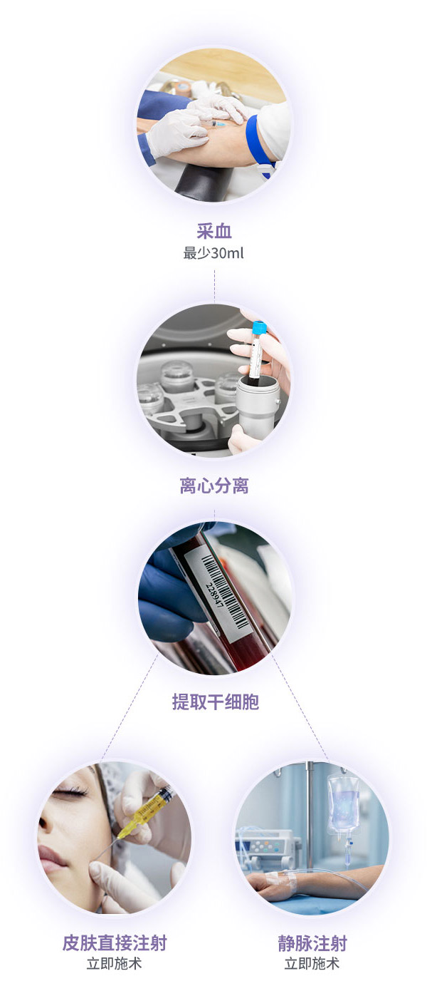 DA 自体血液干细胞治疗的施术流程