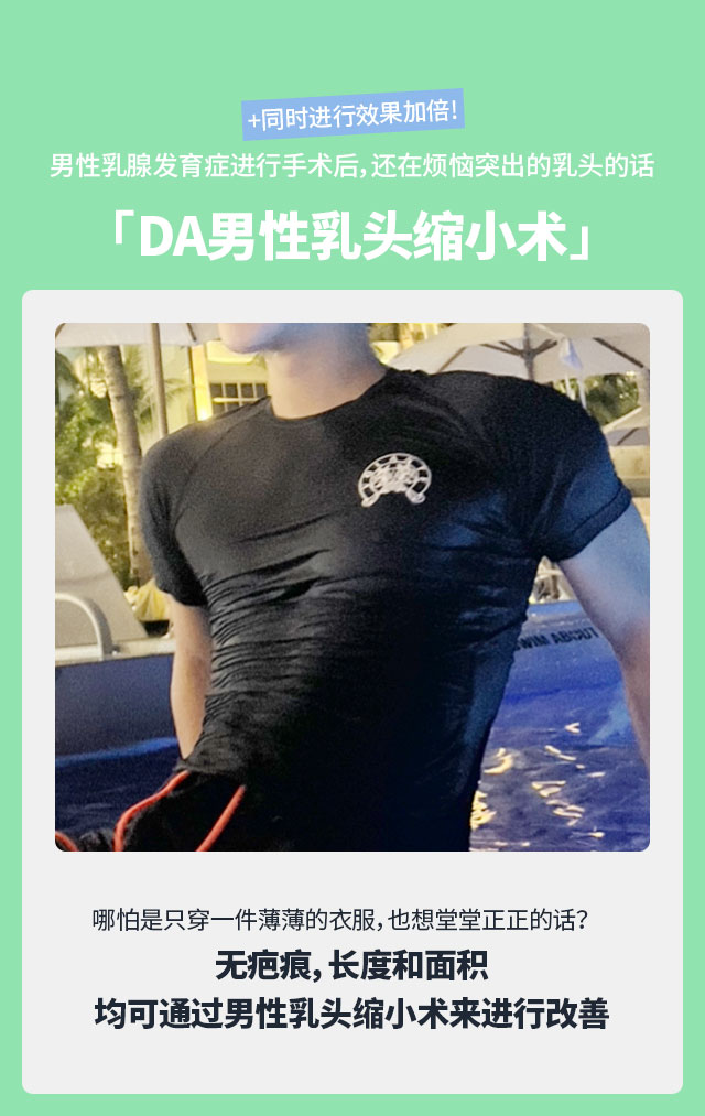 男性乳腺发育症