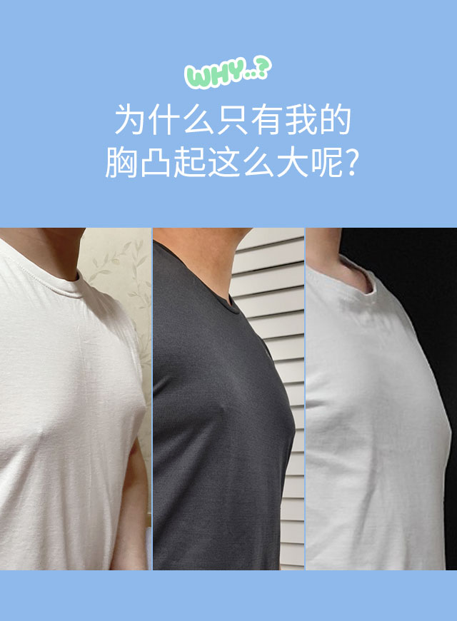 男性乳腺发育症