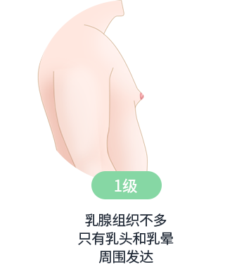 男性乳腺发育症