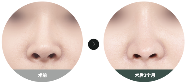 Nose Short 02 02n Png