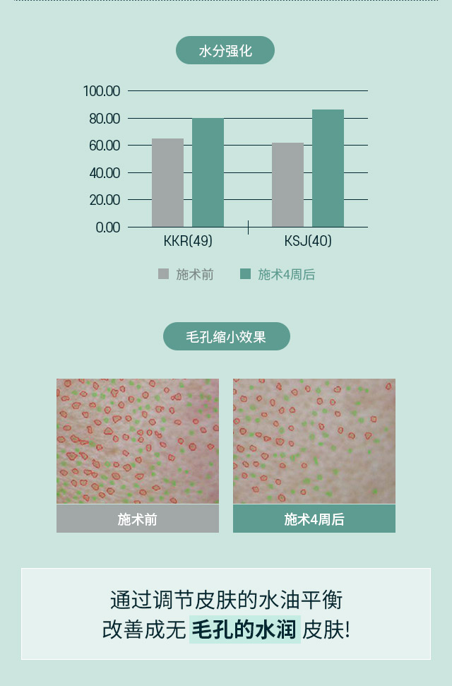 通过调节皮肤的水油平衡改善成无毛孔的水润皮肤!