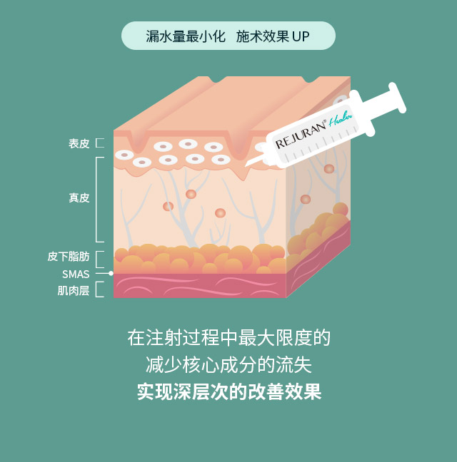 在注射过程中最大限度的减少核心成分的流失实现深层次的改善效果