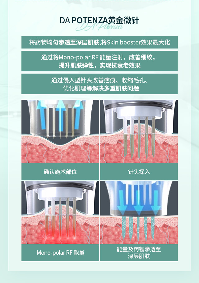 与DA丽珠兰搭配的优选施术-DA POTENZA黄金微针