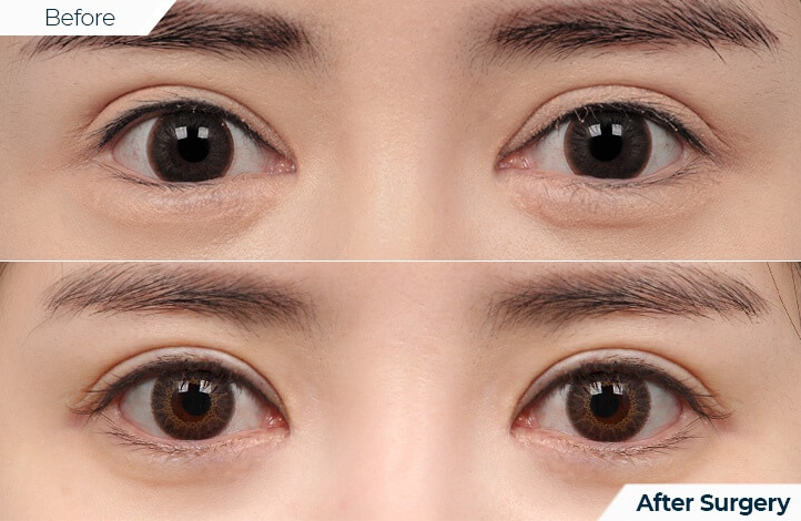 상품10前后照片