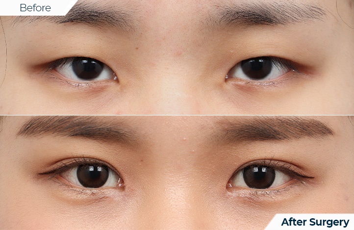 상품11前后照片