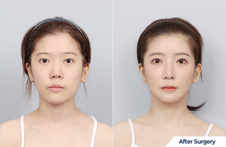 상품12前后照片