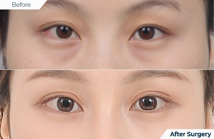 상품13前后照片