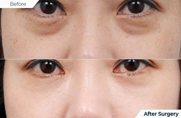 상품14前后照片