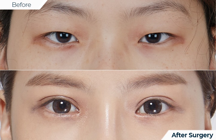 상품17前后照片