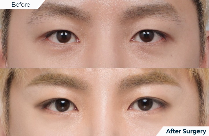 상품18前后照片