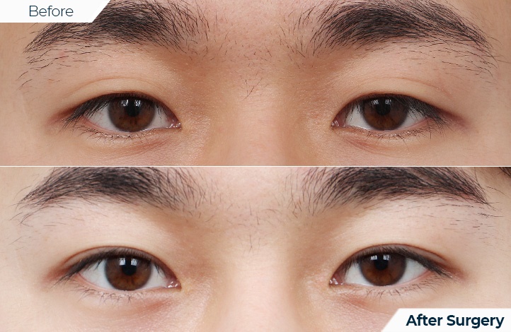 상품19前后照片