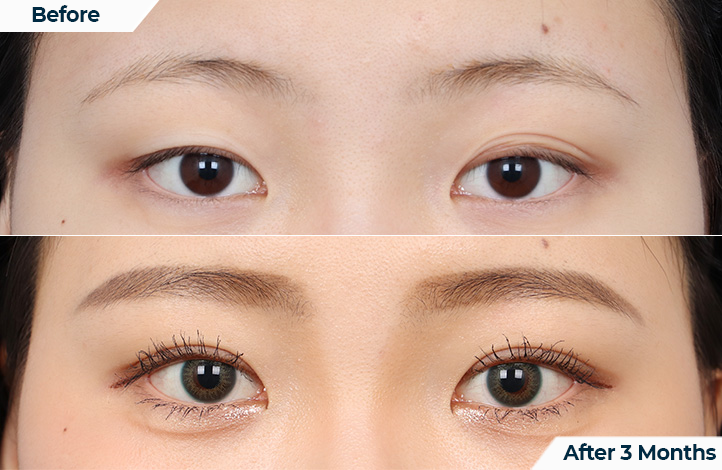 상품20前后照片