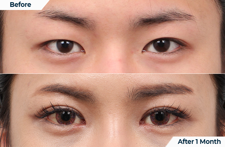 상품22前后照片