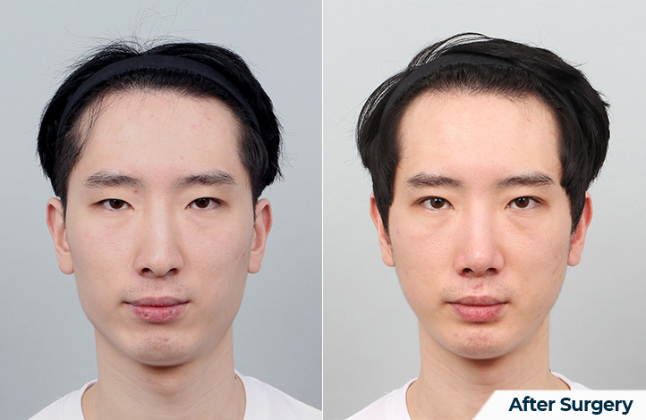 상품23前后照片