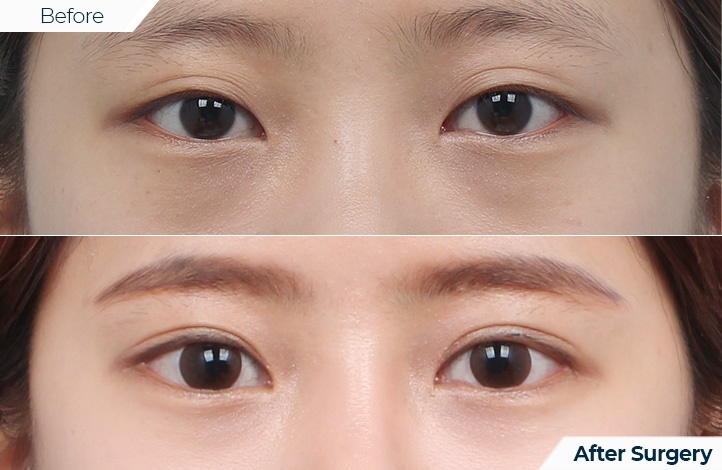 상품24前后照片