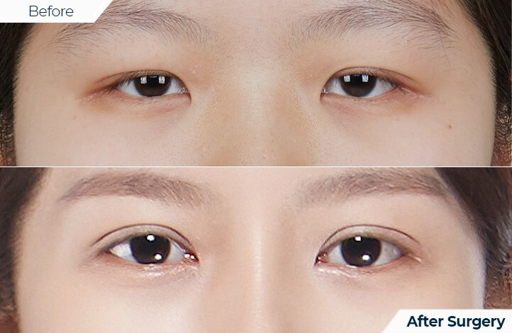 상품25前后照片