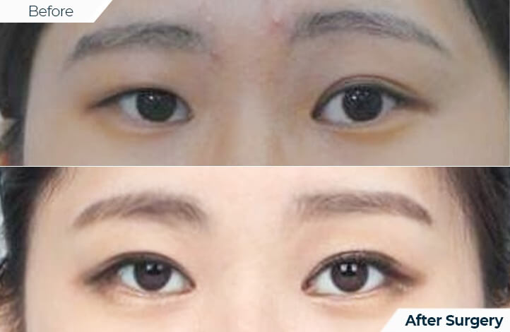 상품26前后照片