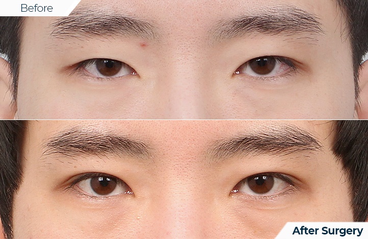 상품27前后照片