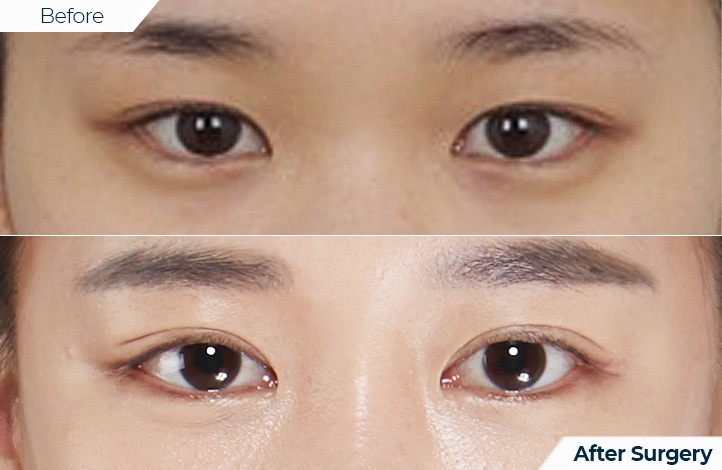 상품28前后照片