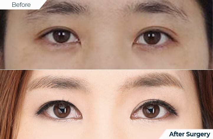 상품29前后照片