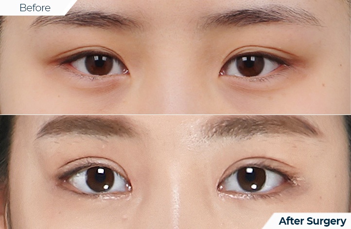 상품33前后照片