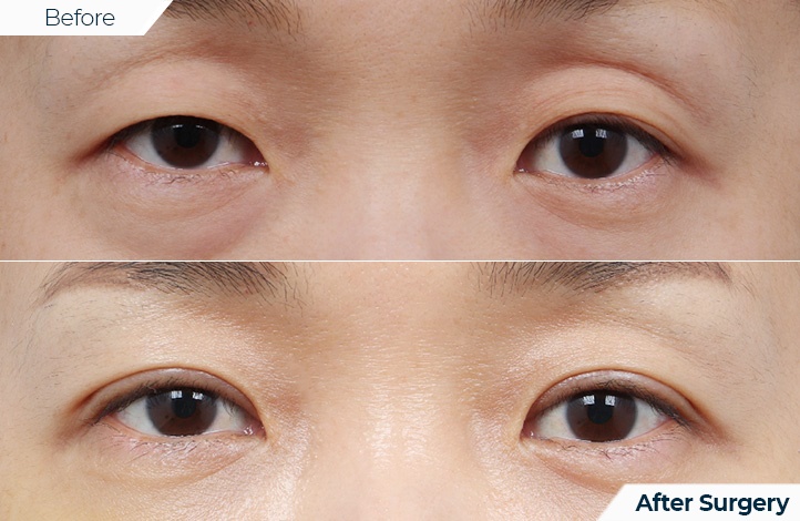 상품34前后照片