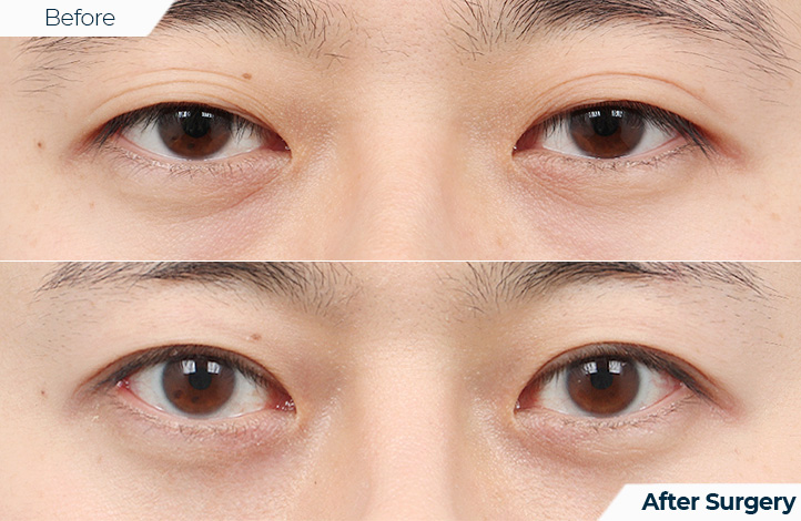 상품35前后照片