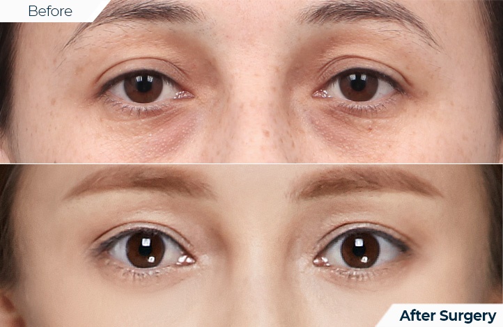 상품36前后照片