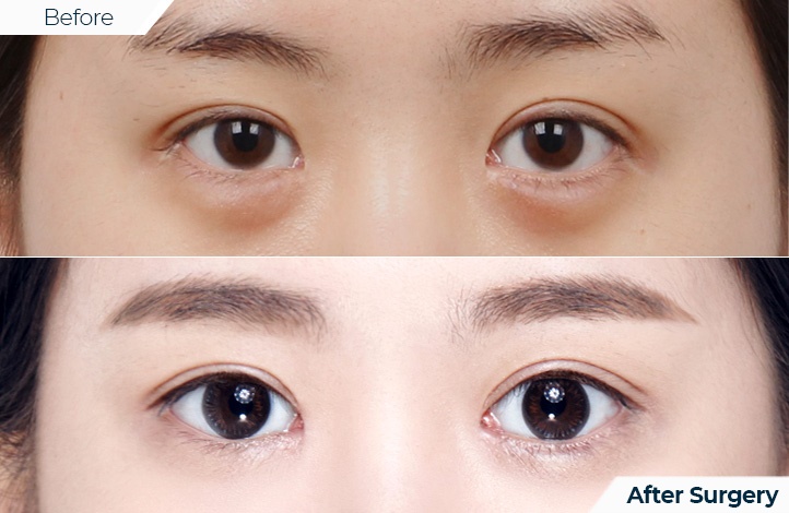 상품37前后照片