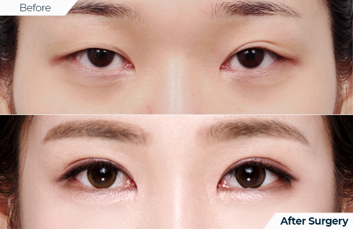 상품38前后照片