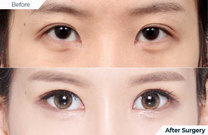 상품40前后照片