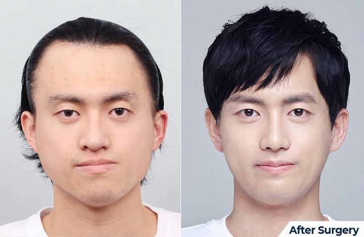 상품41前后照片