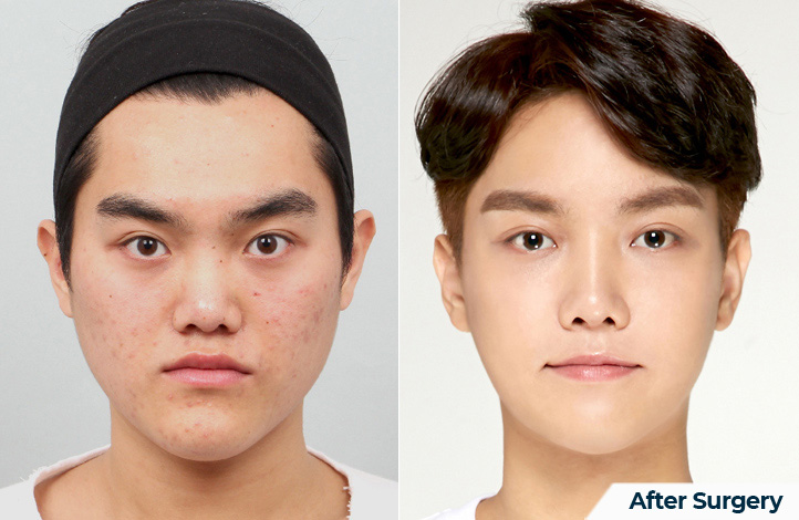 상품43前后照片