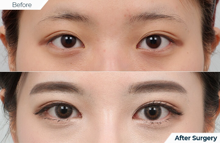 상품44前后照片