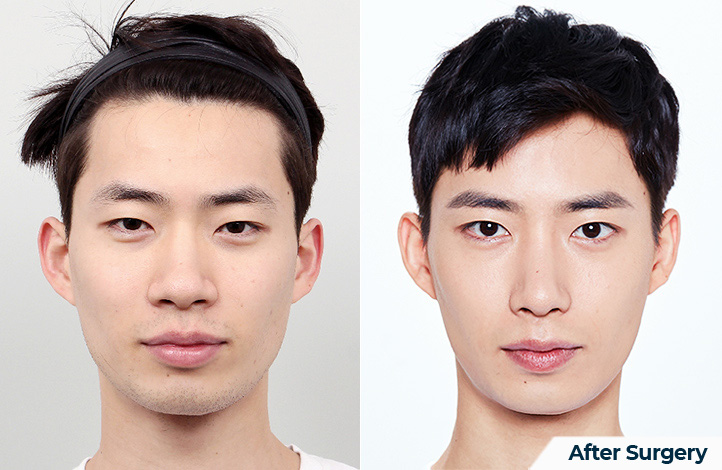 상품46前后照片