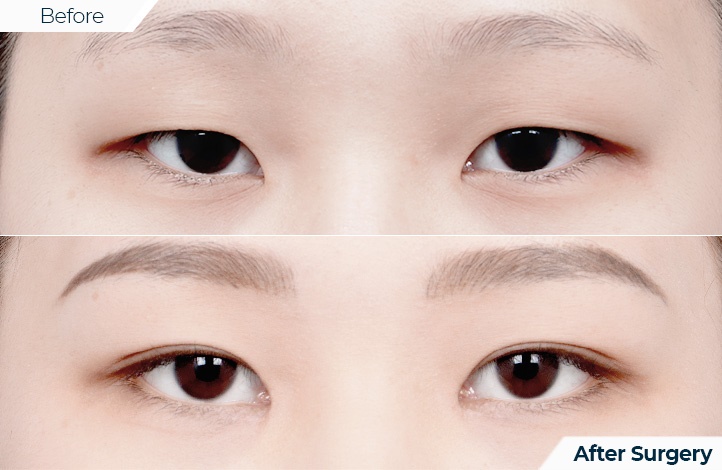 상품47前后照片