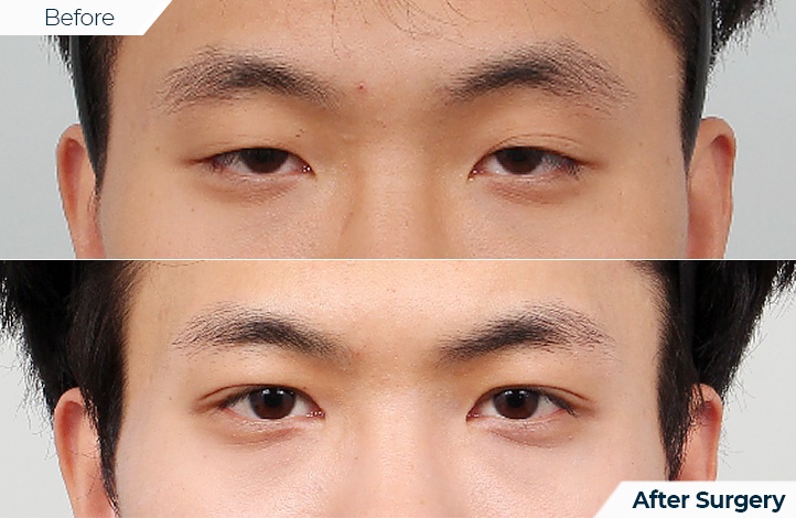 상품48前后照片