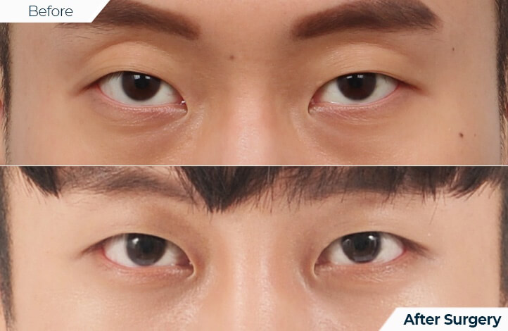 상품50前后照片