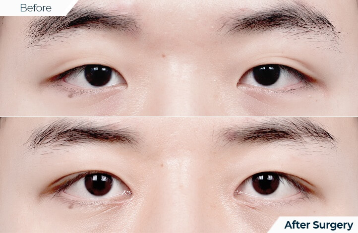 상품51前后照片